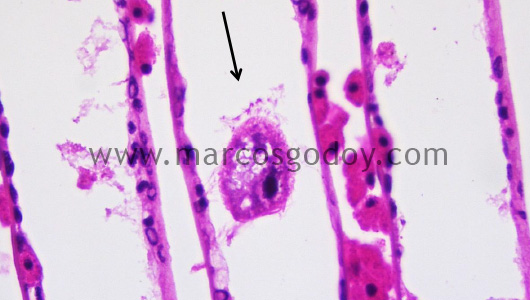 mytilus-chilensis-protozoa-v