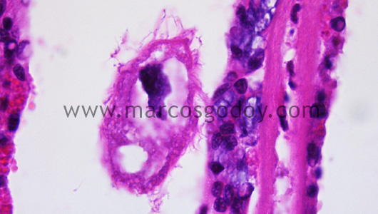 mytilus-chilensis-protozoa-x