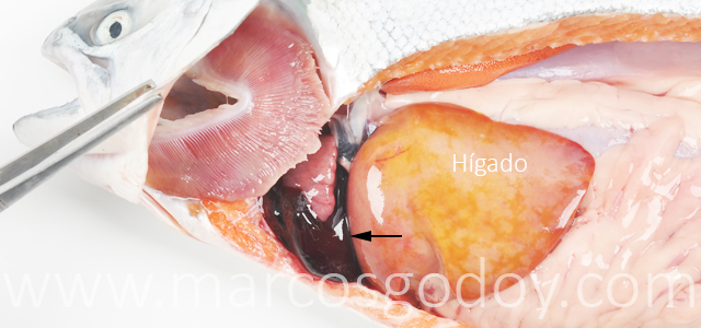 Hemopericardio Salmon coho V